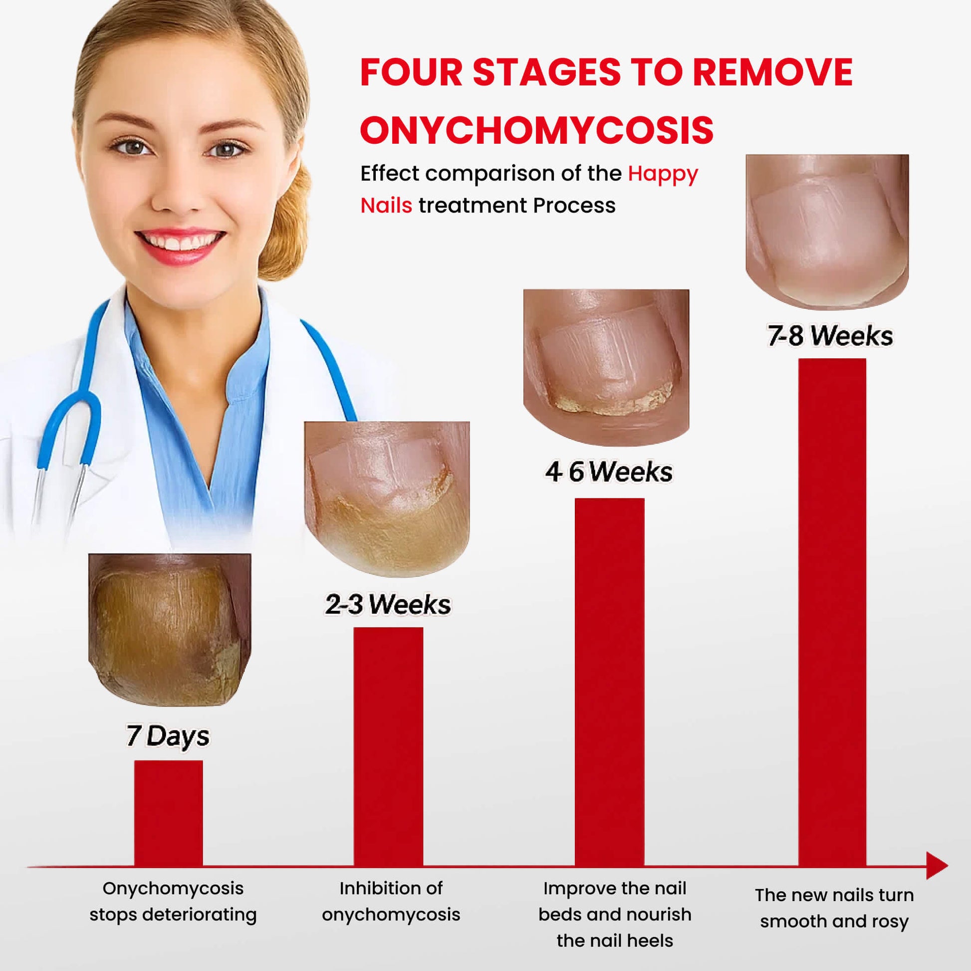 1x Happy Nails Fungal Nail Treatment Toenail Fungus Removal