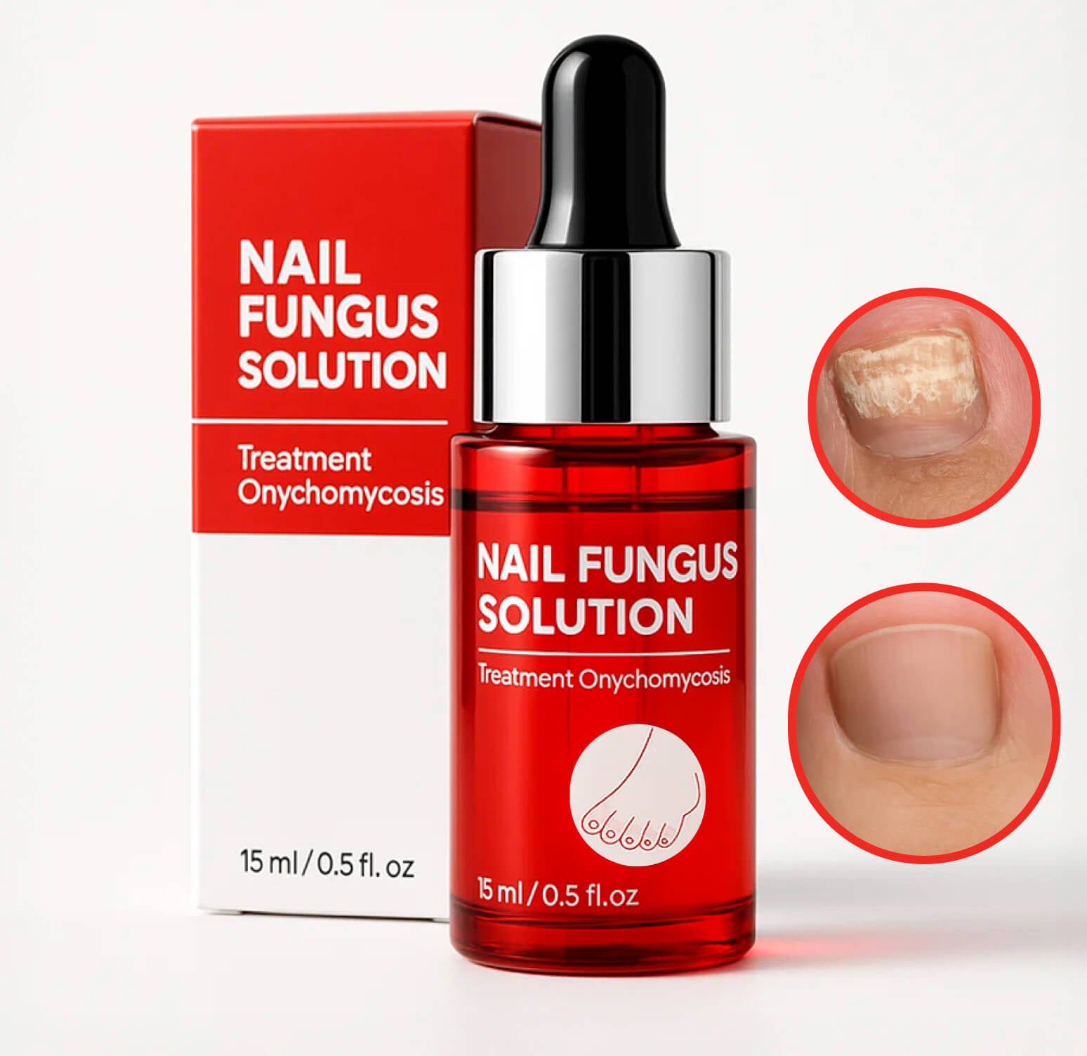 1x Happy Nails Fungal Nail Treatment Toenail Fungus Removal