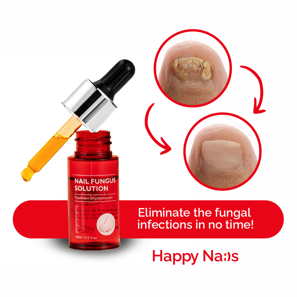 1x Happy Nails Fungal Nail Treatment Toenail Fungus Removal