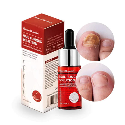 Happy Nails Toe Fungus Treatment Toe Nail Fungus Treatment Toenail Fungus Removal