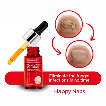 1x Happy Nails Fungal Nail Treatment Toenail Fungus Removal