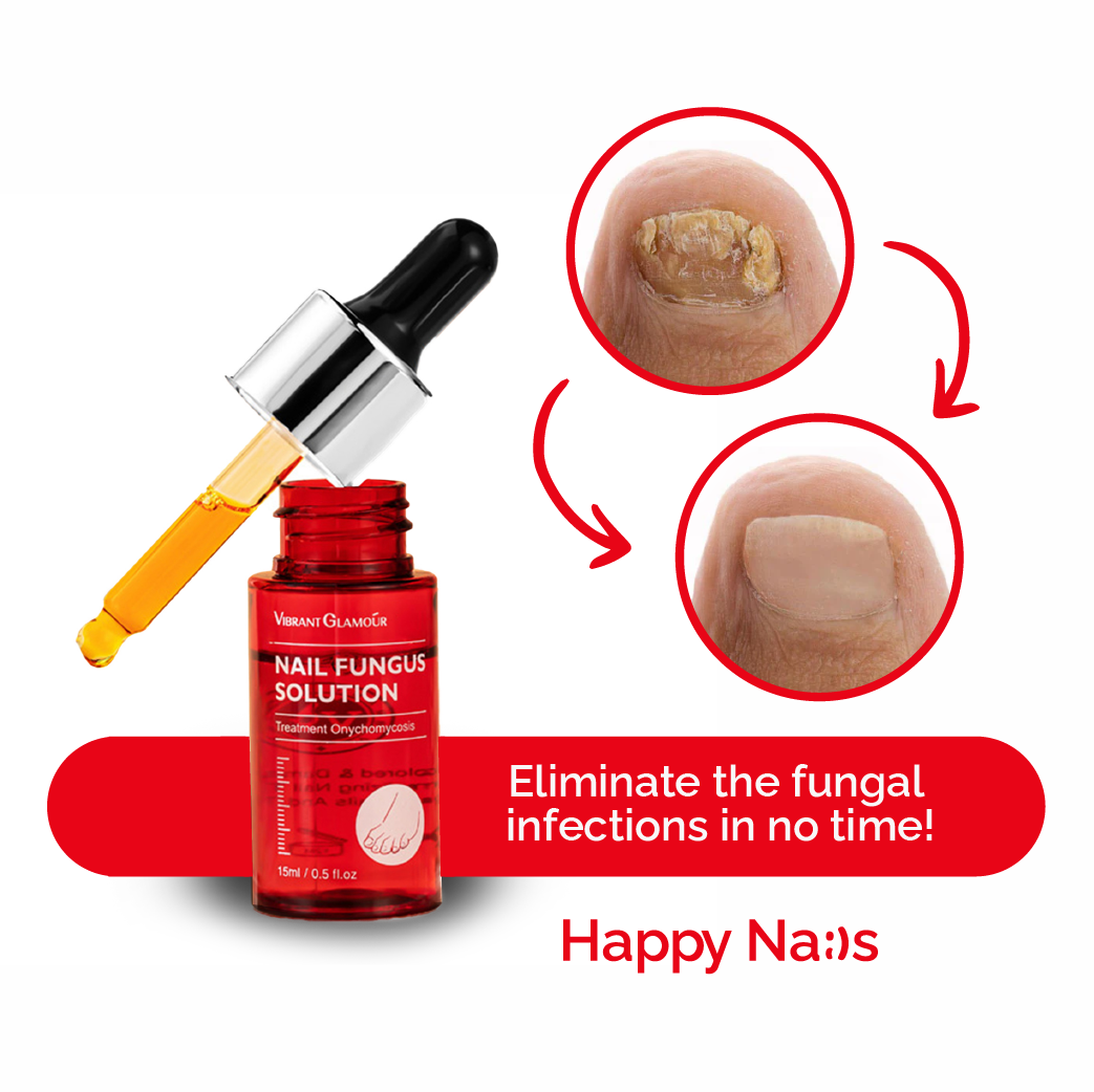 3x Happy Nails Fungal Nail Treatment Toenail Fungus Removal
